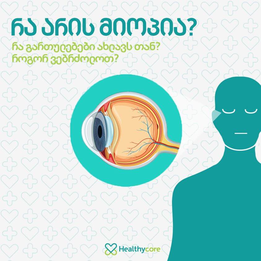 თვალის დაავადება მიოპია